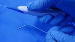 经支气管肺部射频消融术成功